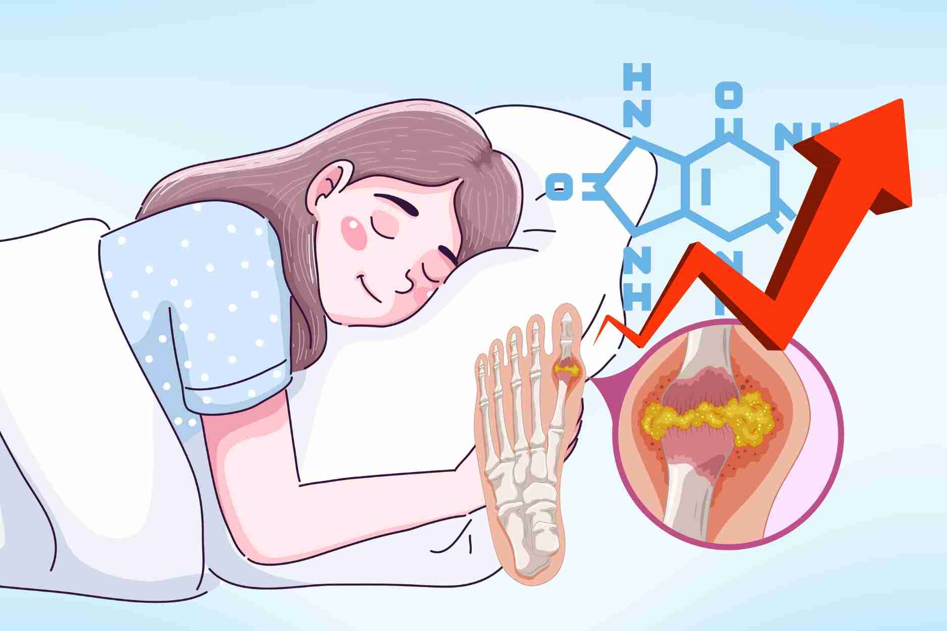 Giấc ngủ tưởng vô hại lại là thủ phạm âm thầm làm tăng axit uric