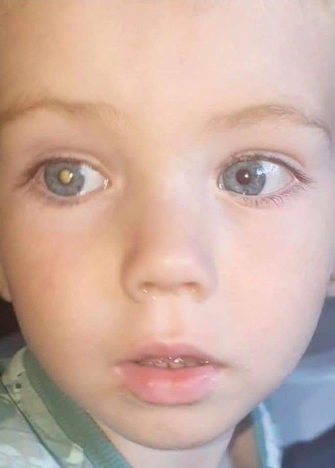 Candlelighters focus on raising awareness of rare childhood eye cancer ...