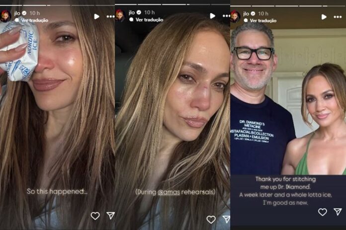 Posts de JLo – Stories Instagram