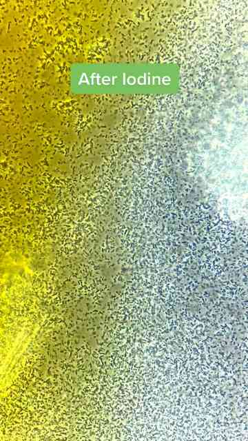 Bacteria Vs Iodine Under The Microscope