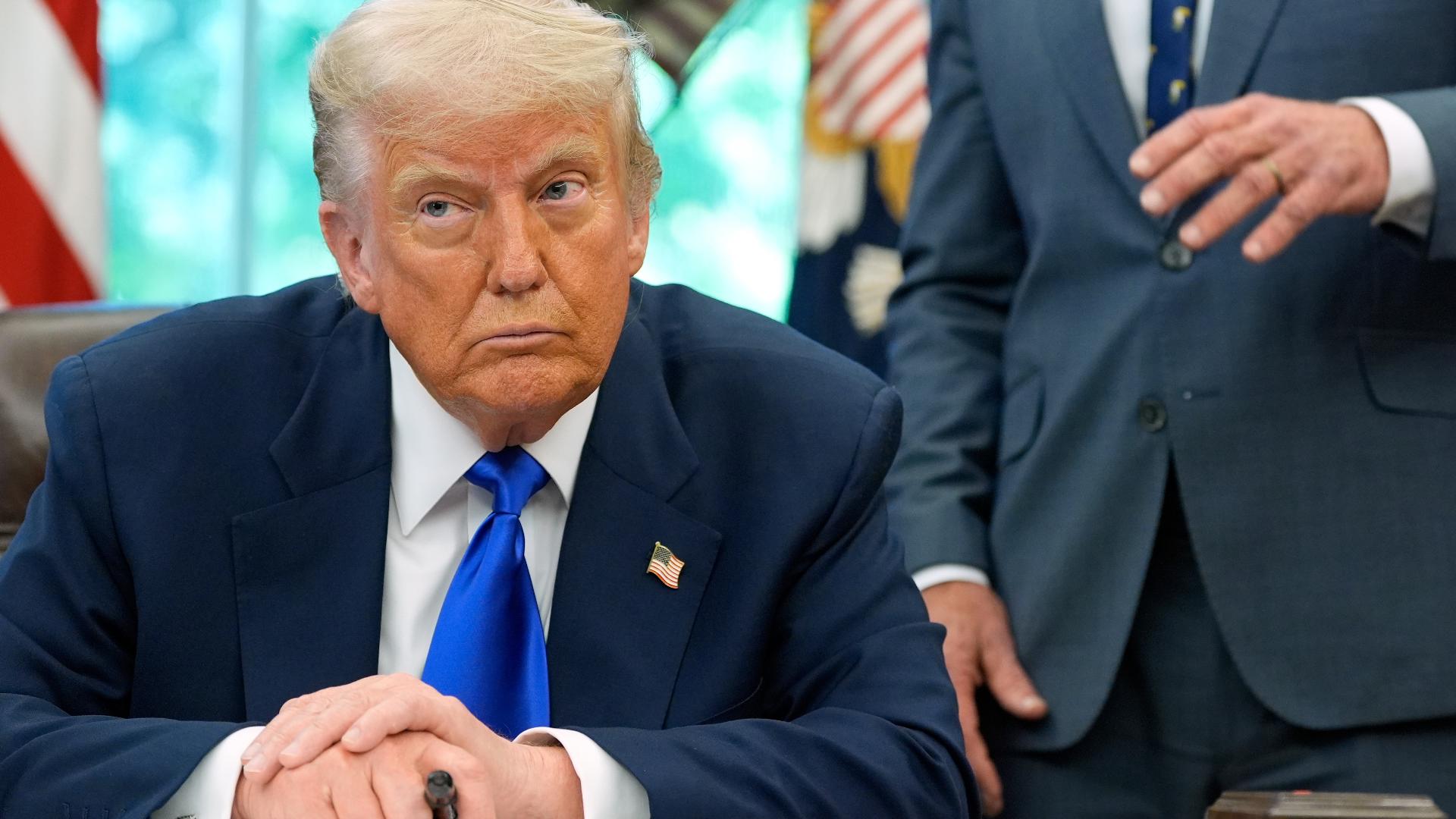 What is chronic venous insufficiency? Trump's diagnosis explained