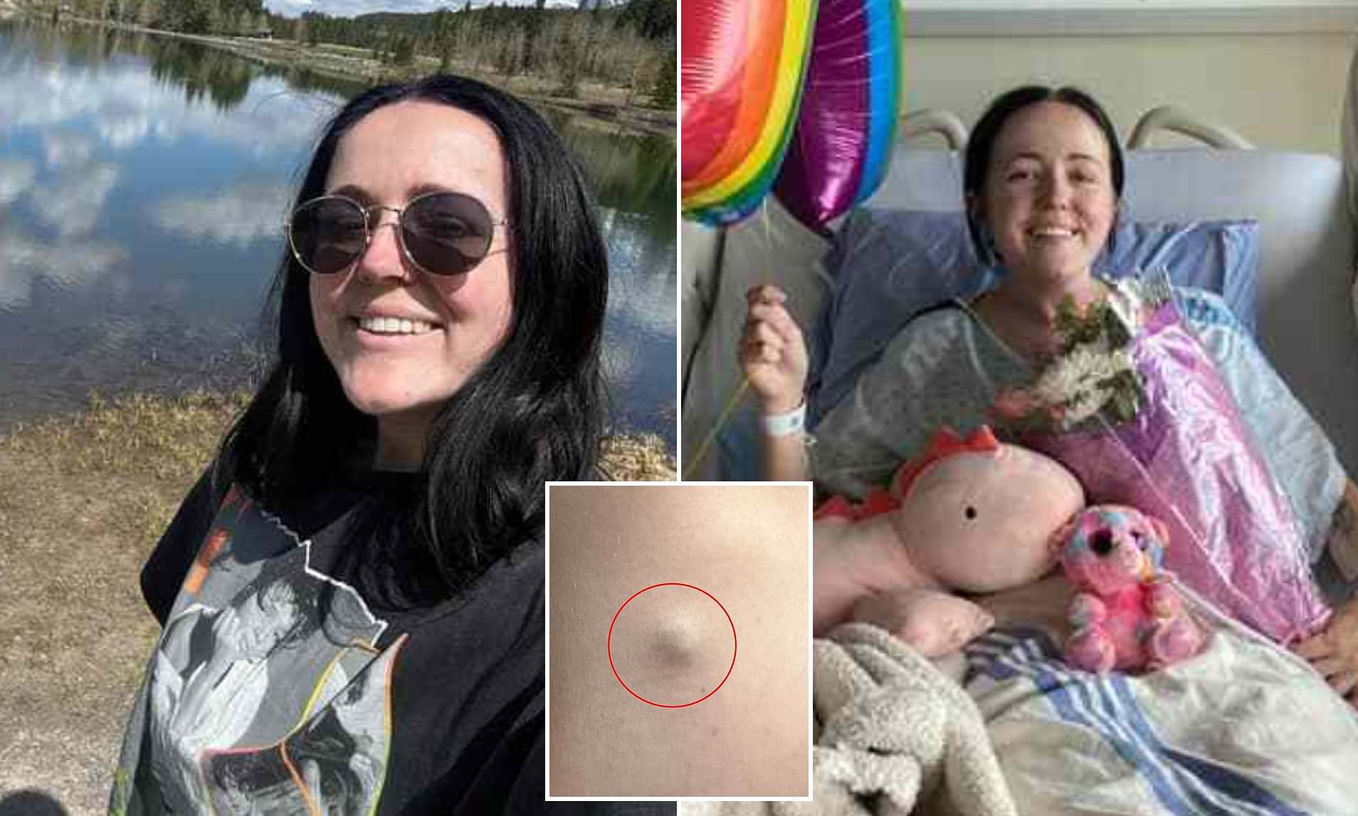 I was diagnosed with stage 4 cancer after strange things began