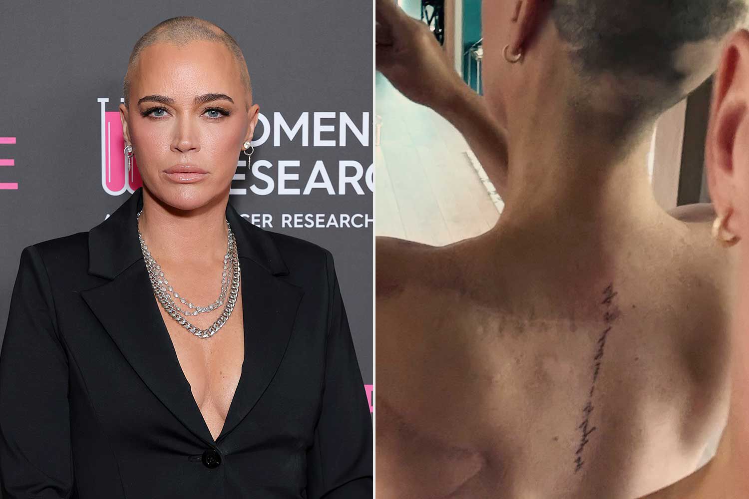 Teddi Mellencamp Debuts Another Tattoo amid Ongoing Cancer Battle, and