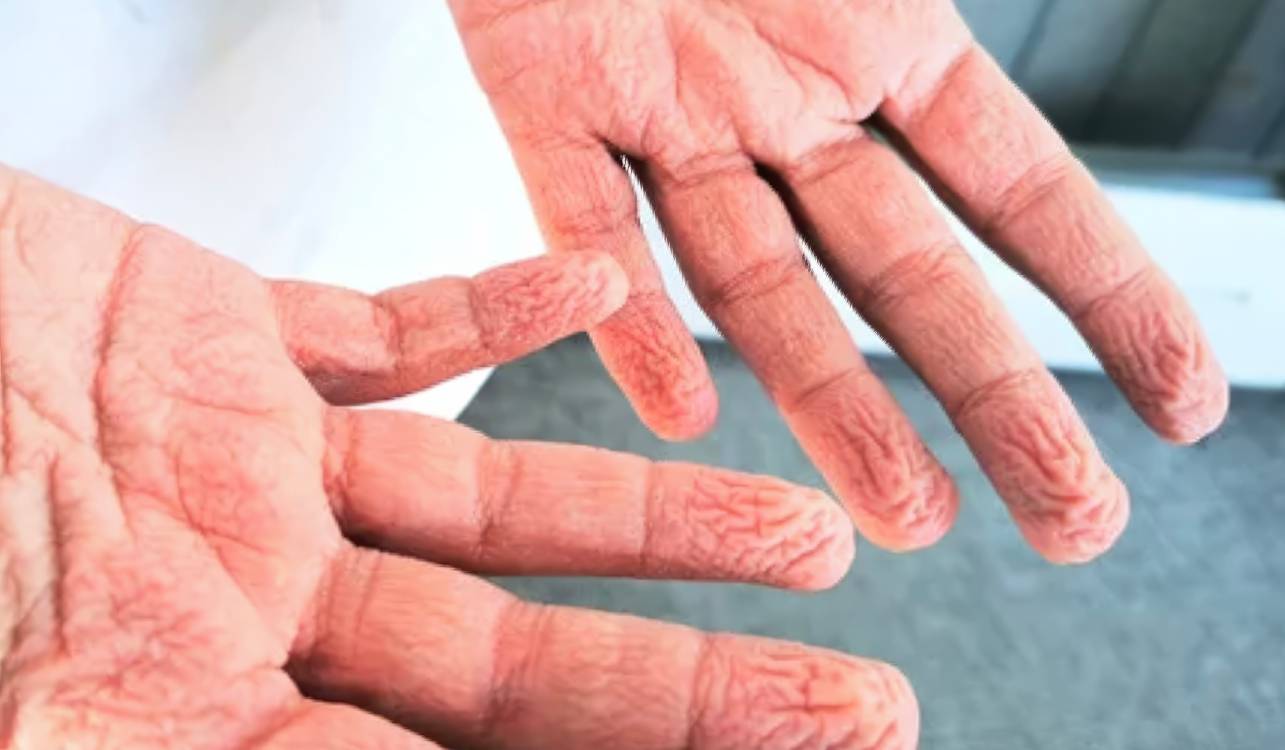 Ce mystère de vos doigts ridés après le bain vient enfin d’être percé ...