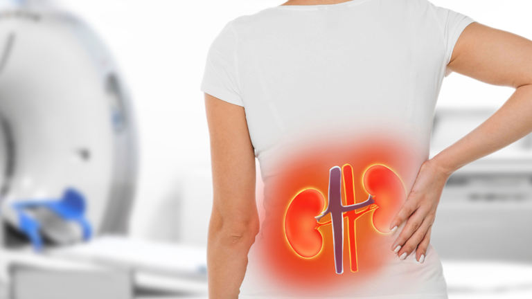 How to check if your kidneys are healthy