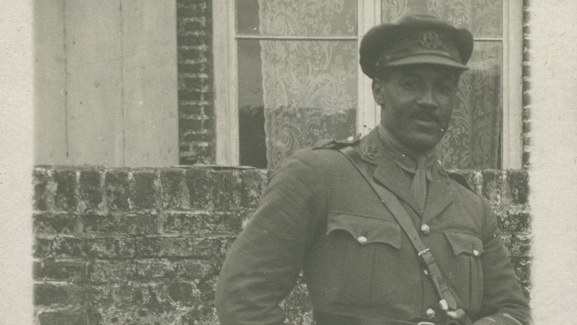 Frontotemporal Dementia The Disorder Affecting Bruce Willis