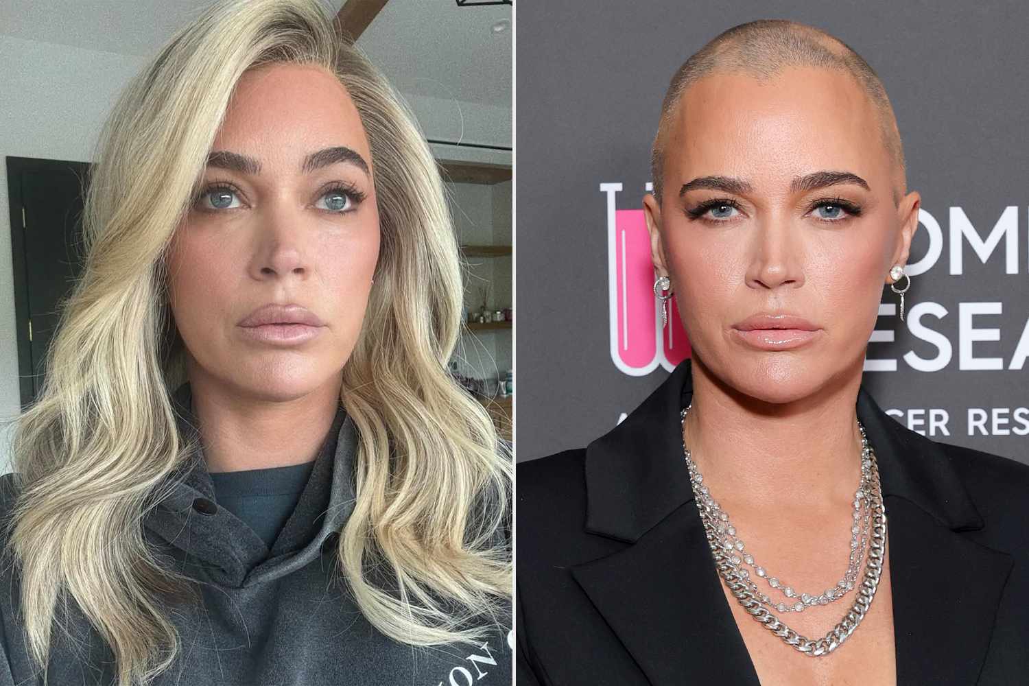 Teddi Mellencamp on 'DaytoDay Decision' of Wearing a Wig amid Cancer(01)