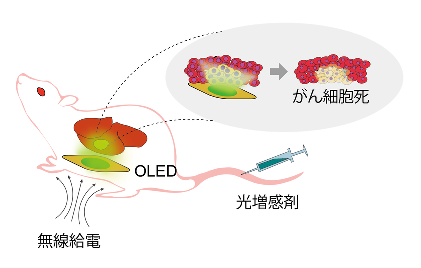 深部臓器がんに対する新規治療法発展：「体内埋め込み型ワイヤレスOLEDデバイス」によるメトロノミック光線力学療(mPDT)技術