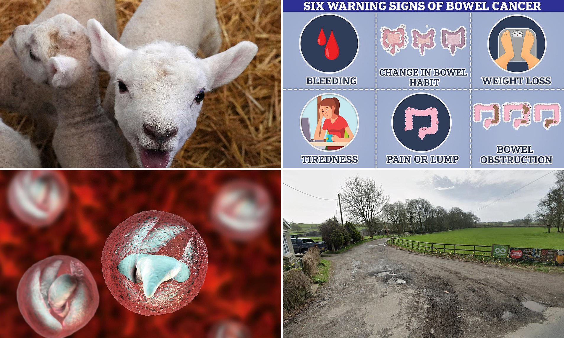 Outbreak of gruesome parasite that causes 'bowel cancer-like' symptoms ...