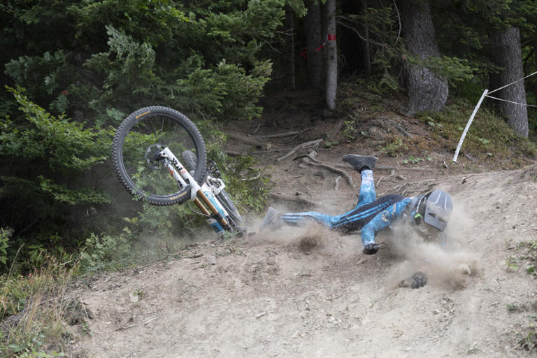 The 5 most common MTB injuries, according to riders who learned the ...