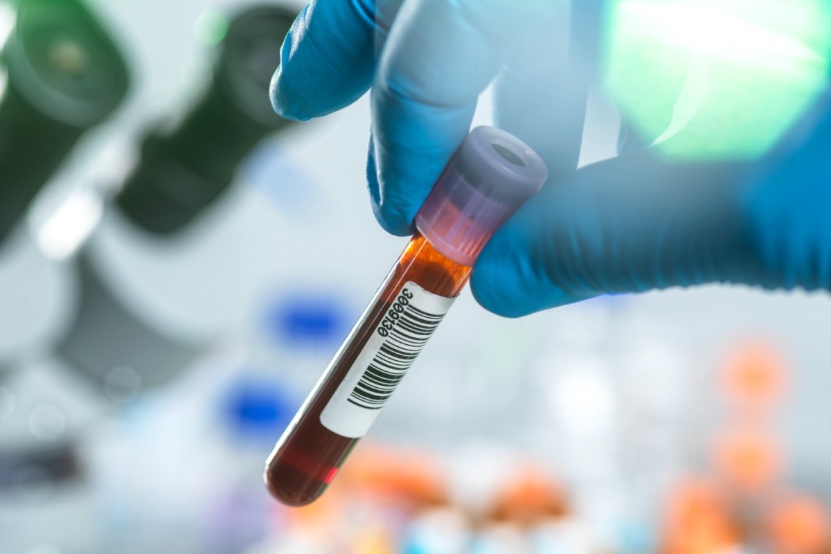 NEW FDA APPROVED BLOOD TESTS FOR DIAGNOSING ALZHEIMER S DISEASE visual data 4