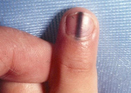 Imagem ilustrativa número 5