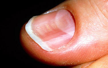 Imagem ilustrativa número 6