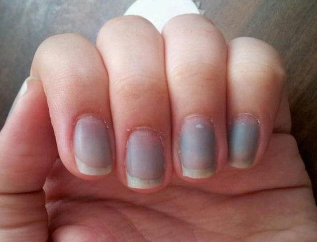 Imagem ilustrativa número 4