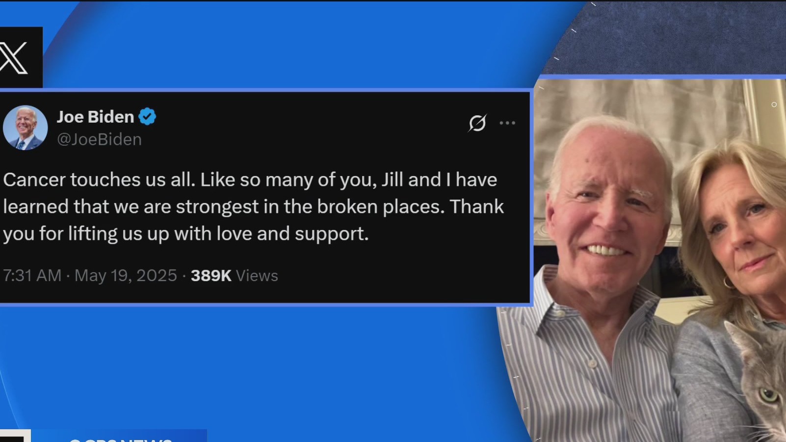 Support pours in after Former President Joe Biden reveals prostate