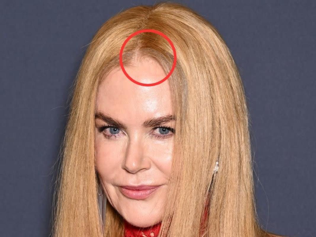 Nicole Kidman Faces Awkward Wardrobe Malfunction at Cannes