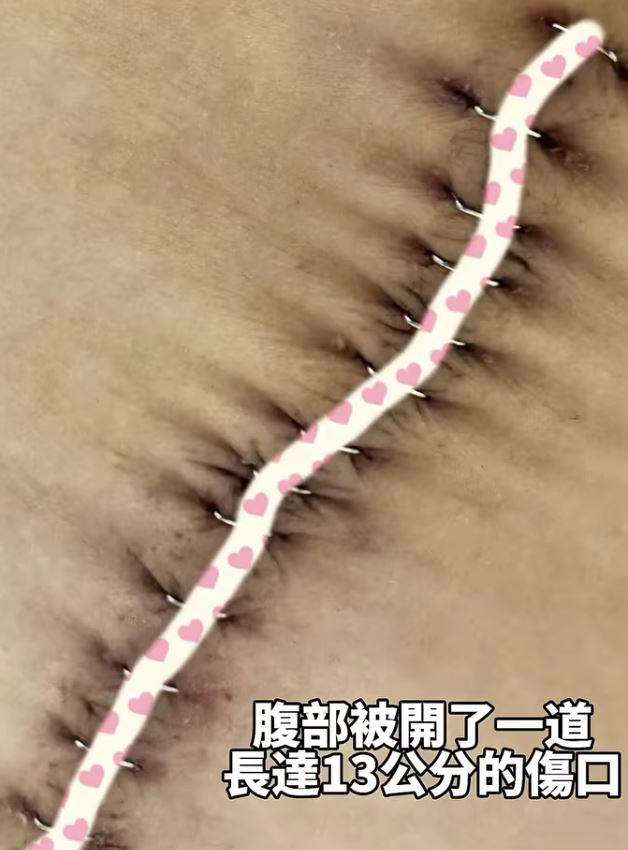 國光女神林茉晶因罹患癌症半年化療六次，副作用掉髮後直接理光頭。（圖／翻攝自林茉晶IG）