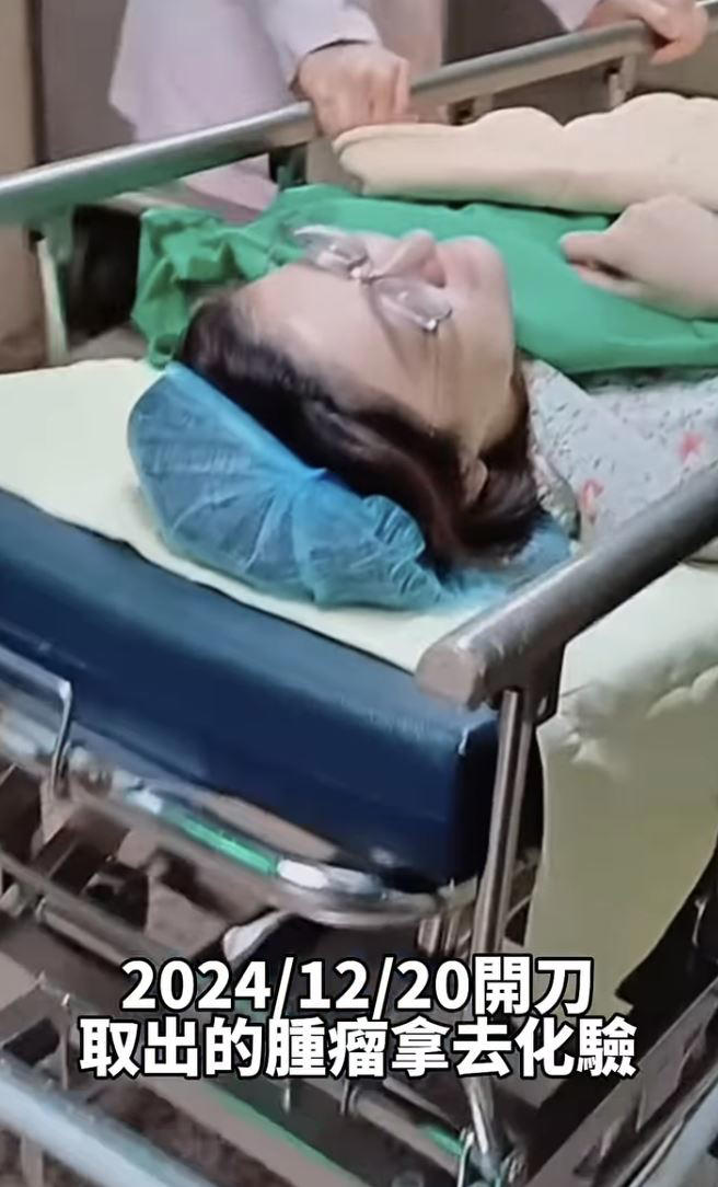 國光女神林茉晶因罹患癌症半年化療六次，副作用掉髮後直接理光頭。（圖／翻攝自林茉晶IG）
