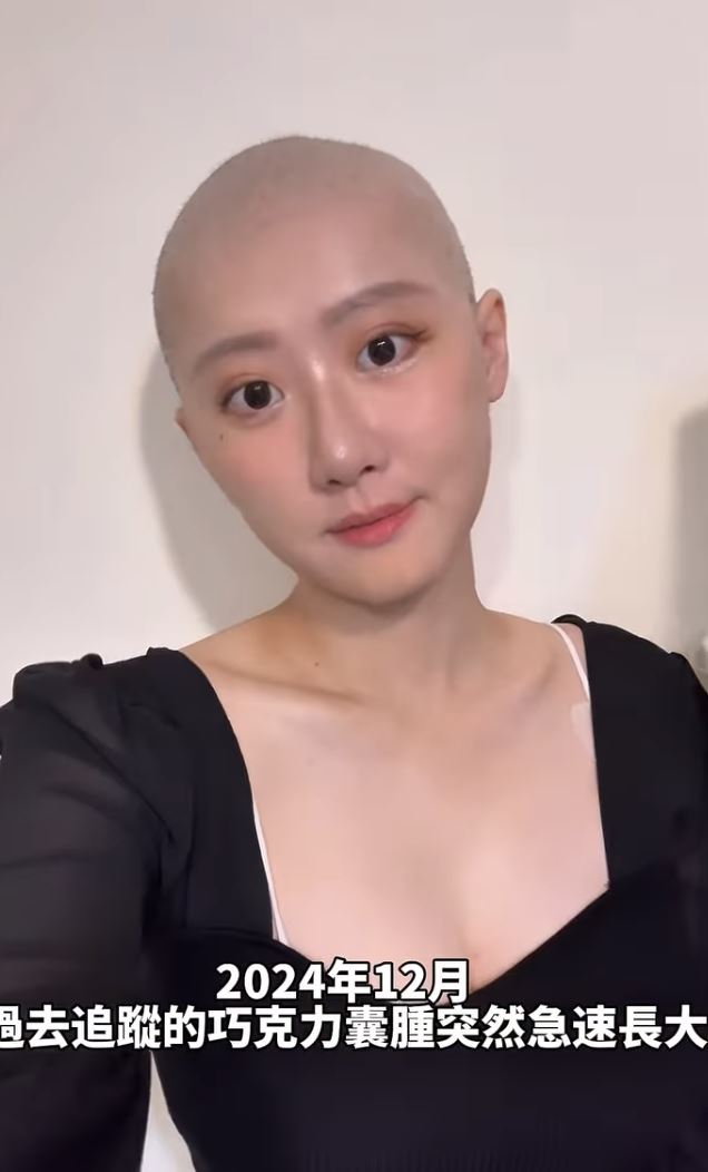 國光女神林茉晶因罹患癌症半年化療六次，副作用掉髮後直接理光頭。（圖／翻攝自林茉晶IG）