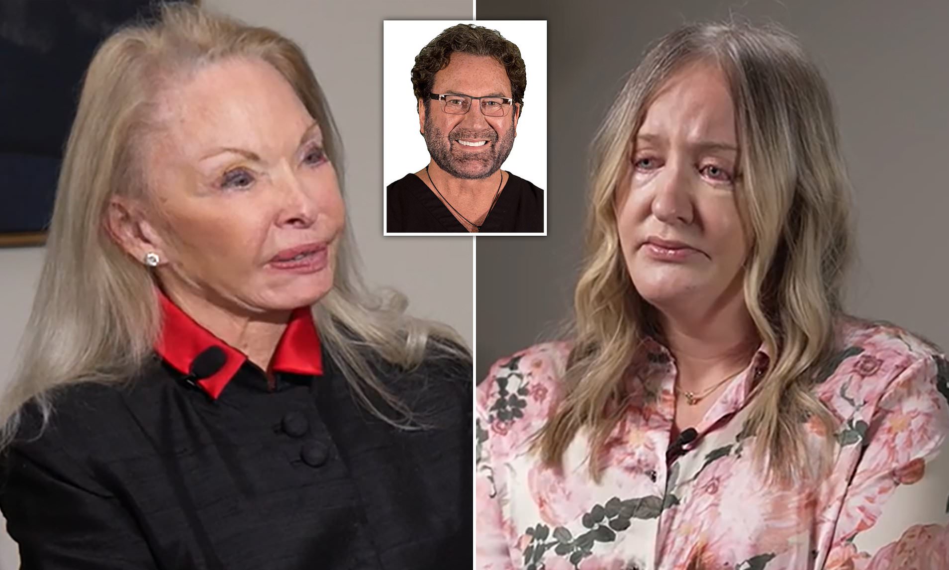 Distraught women show what plastic surgeon did to their faces after ...