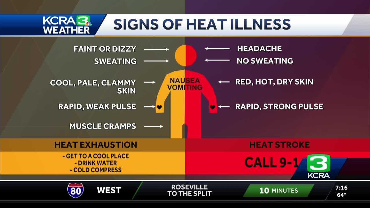 Northern California heat illnesses: What to know about heat exhaustion ...