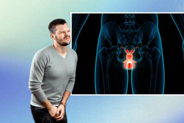 Ponga atención: ¿dónde duele cuando hay problemas de próstata?
