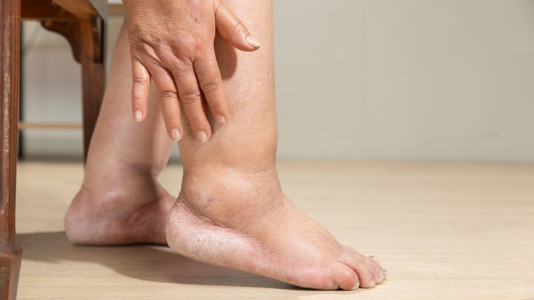 8 early symptoms of heart blockage to watch out for
