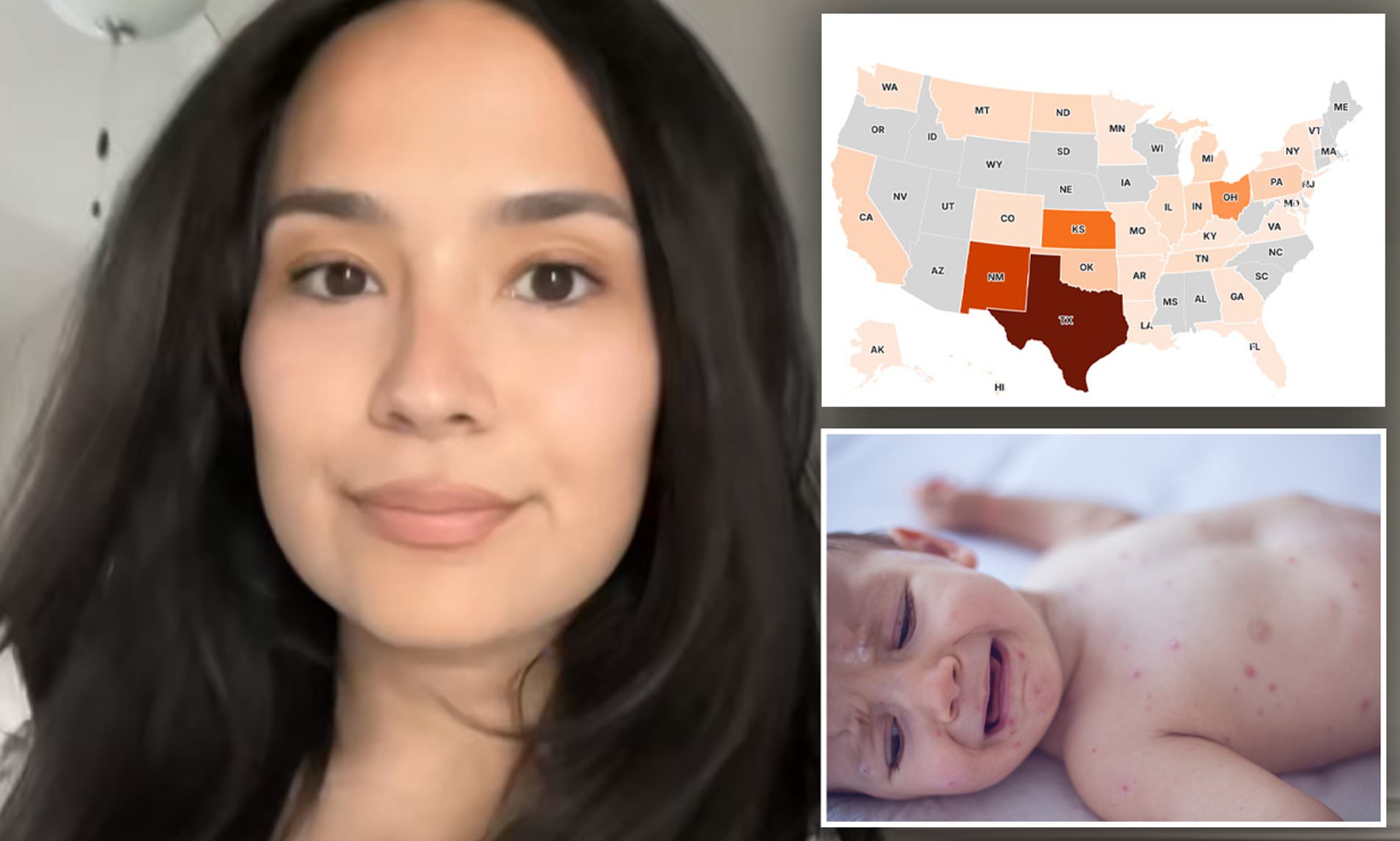 My son caught world's most infectious disease and could suffer