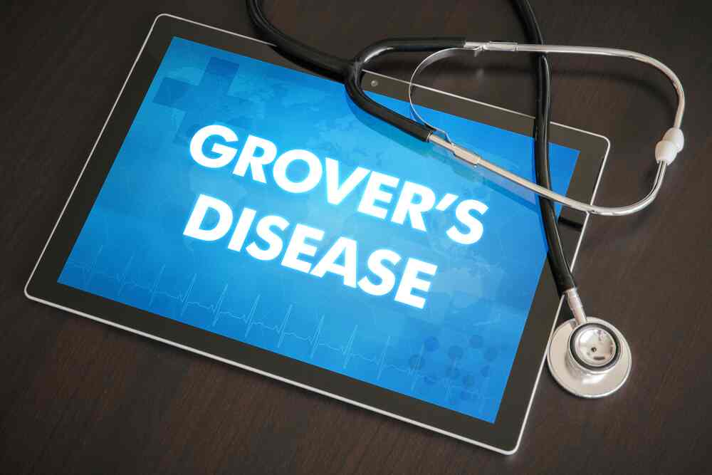 Grover's Disease: Causes, Symptoms, Diagnosis and Treatment