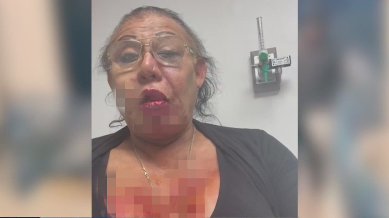 LA man charged with attempted murder, hate crimes in attacks on ...