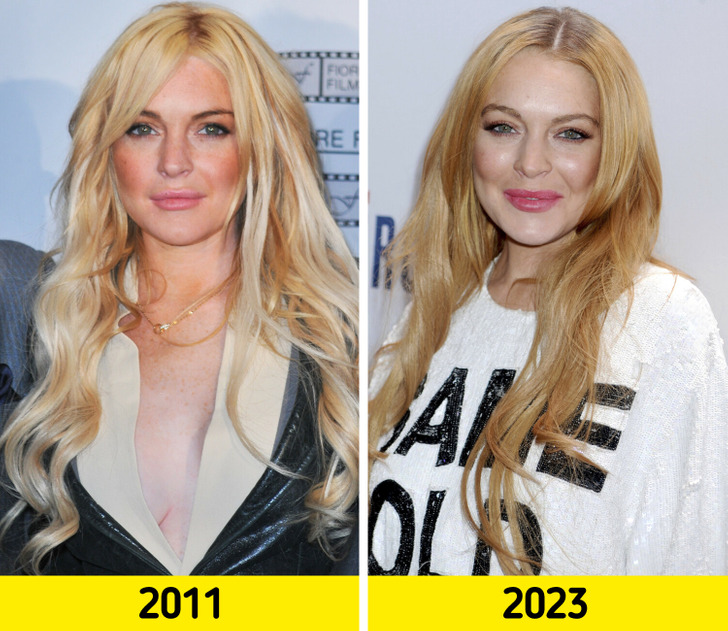 Lindsay Lohan’s New Appearance Sparks Speculation About “Face Transplant”
