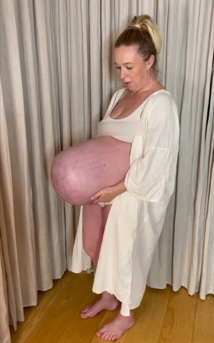 “That’s My Nightmare,” Mom’s Enormous Baby Bump That Sticks “Straight Out” Leaves People Speechless