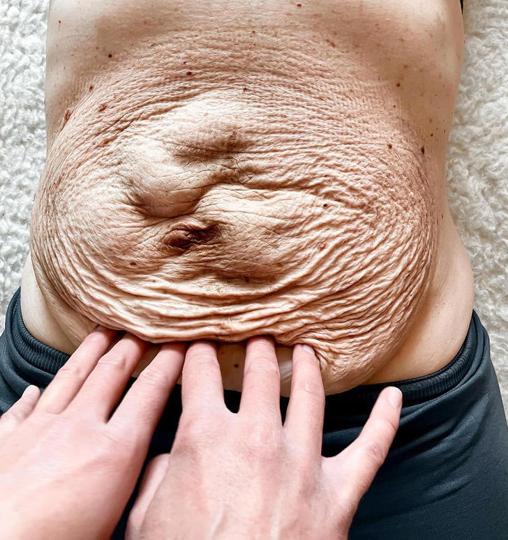 “That’s My Nightmare,” Mom’s Enormous Baby Bump That Sticks “Straight Out” Leaves People Speechless