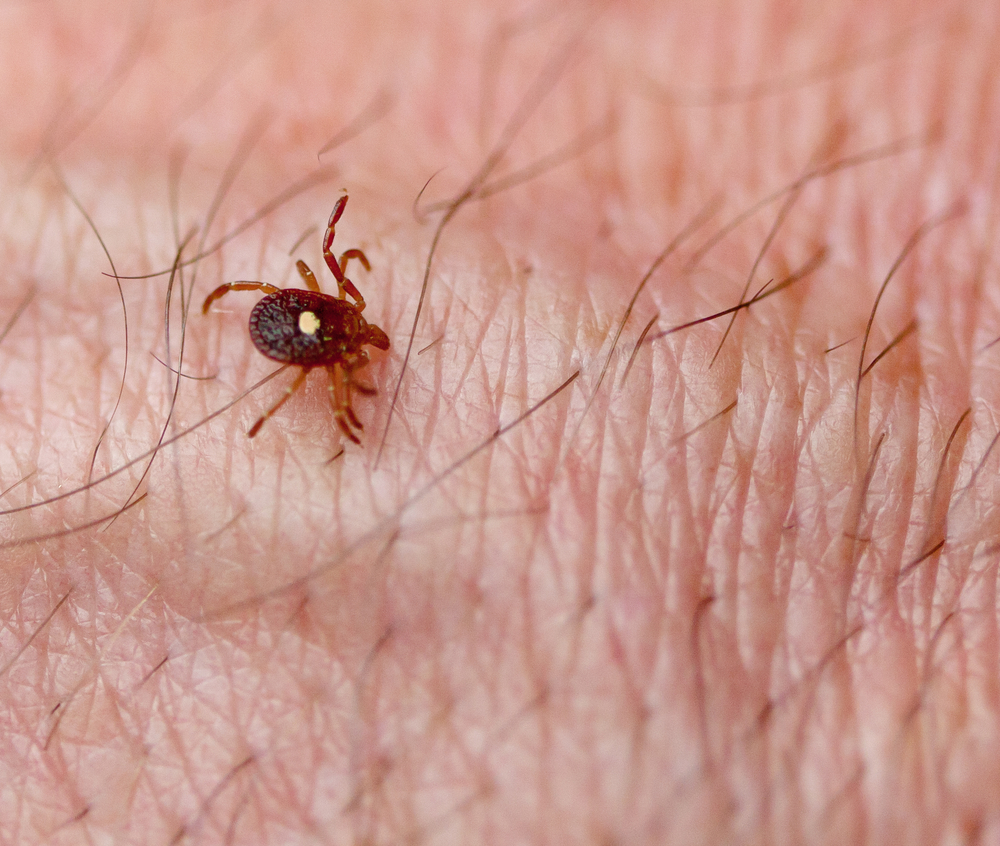 How to Keep Ticks Off You and Your Pets