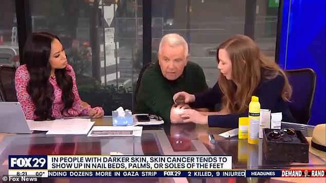 Mike Jerrick, co-host of Good Day Philadelphia, brought dermatologist, Dr. Joanna Walker, on air before the pair discovered a likely-cancerous spot on the hosts' elbow