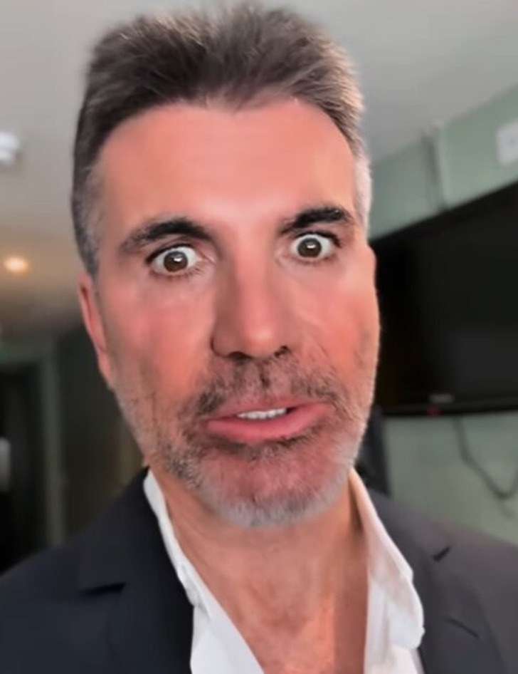 “What Happened to His Face?!” Simon Cowell’s Drastic New Look Leaves