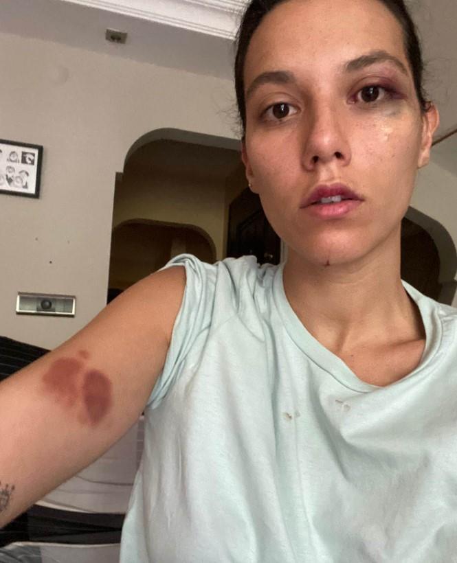 Deniz Bulutsuz ceza sevincini paylaştı! 'Cezaevine gireceği günü bekliyorum'