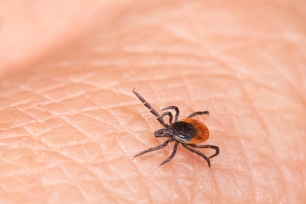 Study documents unusual tick-related arthritis cases