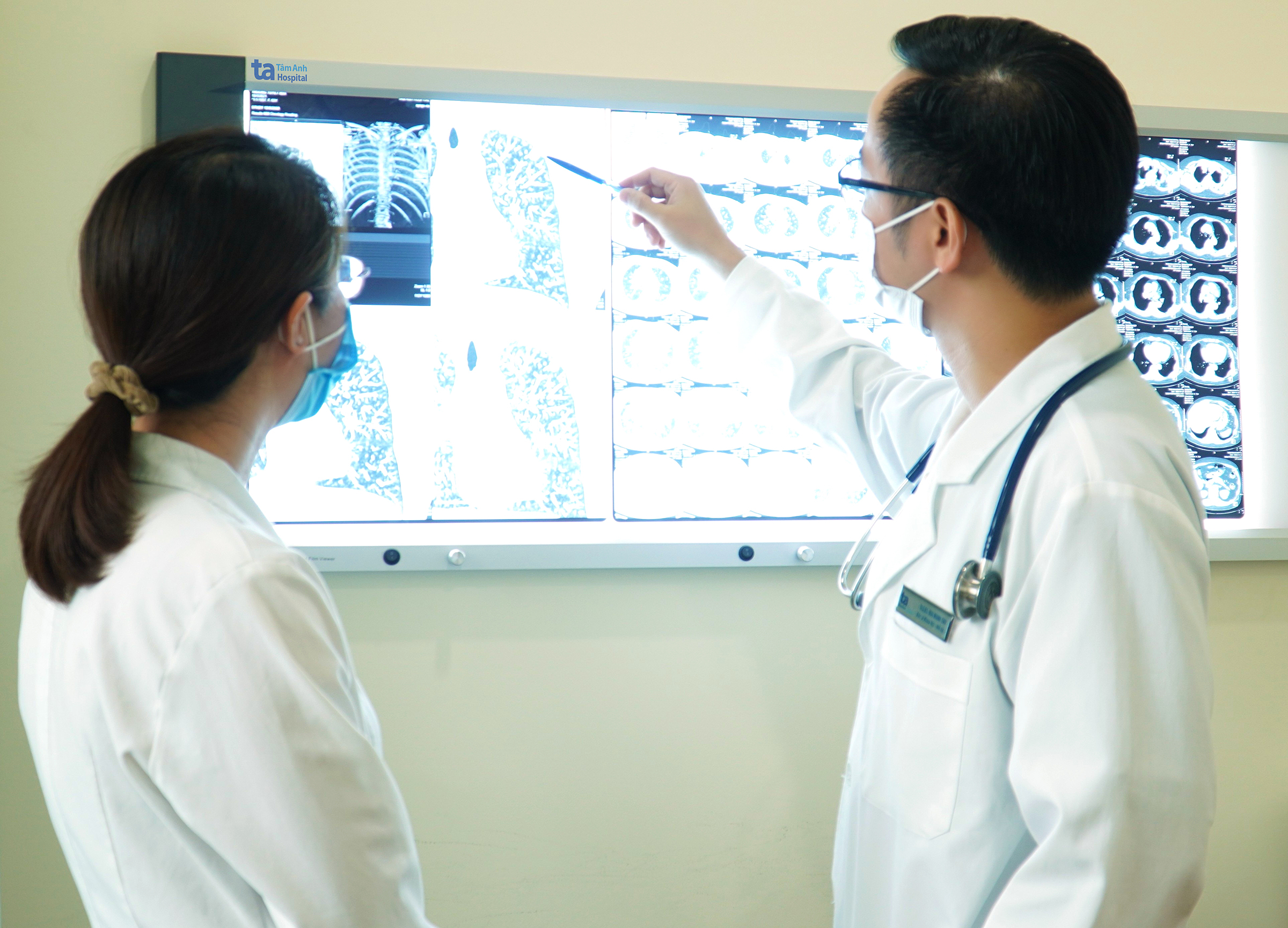 Tràn dịch màng phổi do lao có thể gây ngạt thở