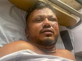 Air India crash survivor Vishwas Ramesh discharged from hospital- Video