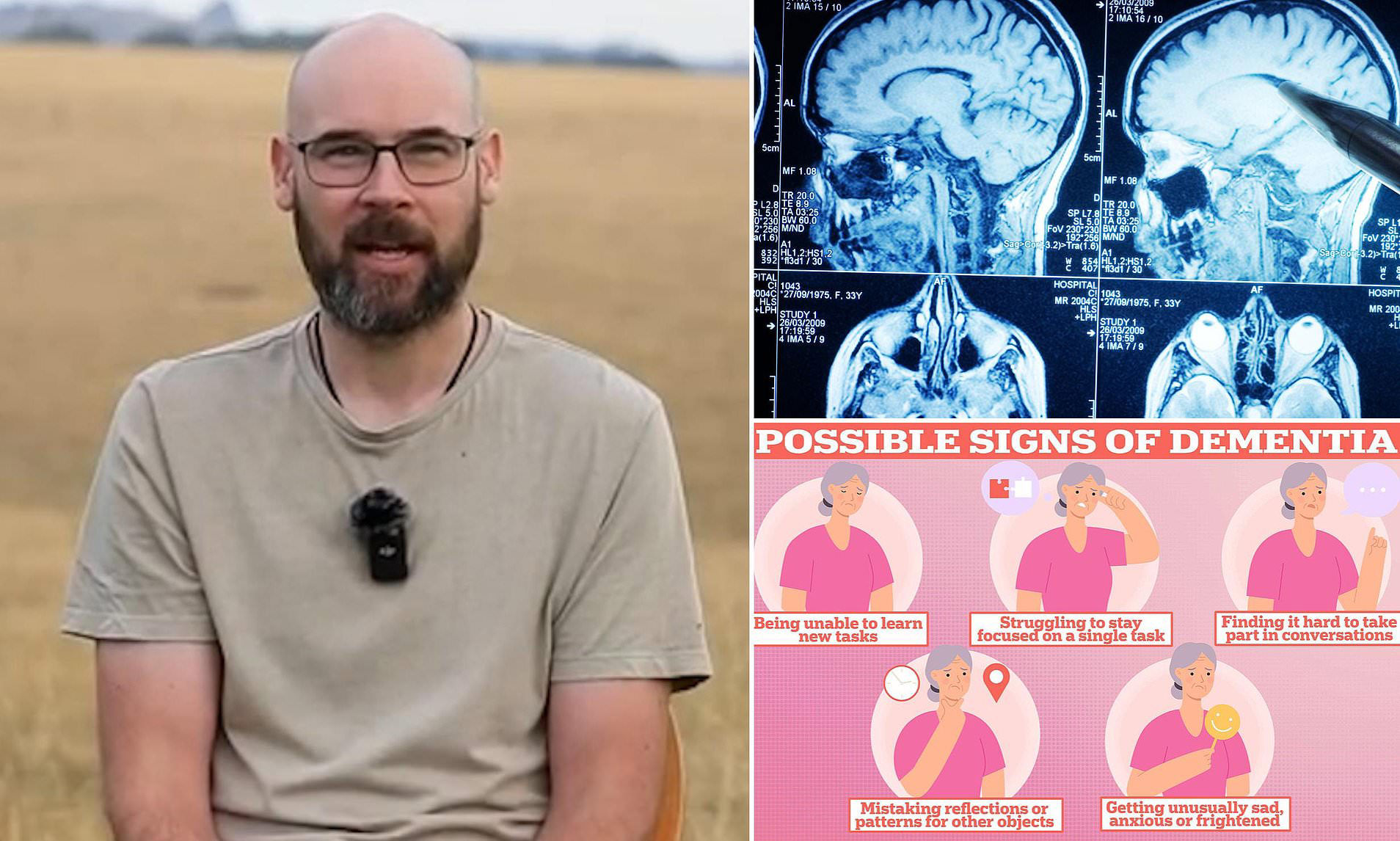 Father of one diagnosed with early onset dementia reveals heartbreaking Father of one diagnosed with early onset dementia reveals heartbreaking