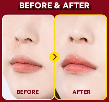 a close-up of skin before and after using the setting.