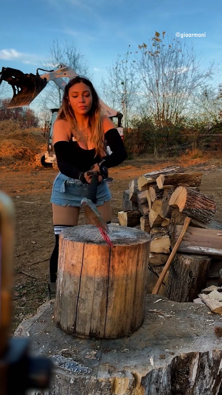 After Surviving Vicious Dog Attack that Ended Her Career, Model Finds a