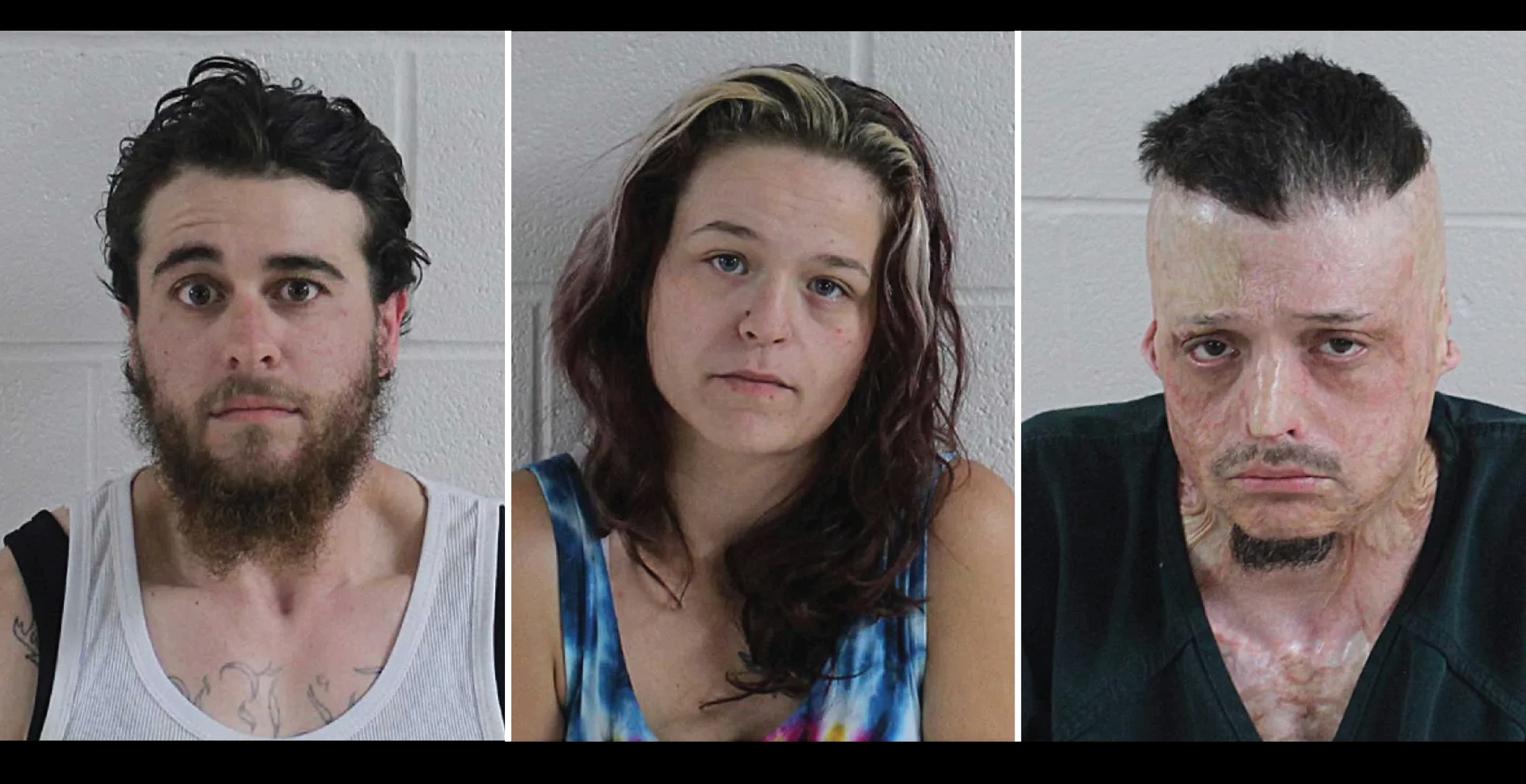 6YearOld Brutally Mauled By Pit Bull After Mom And 2 Men Handcuffed