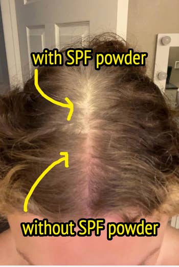 Top view of a person's scalp showing comparison: