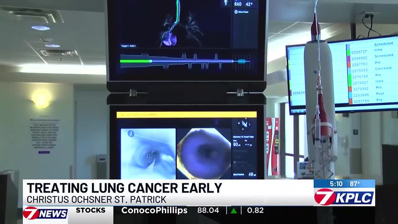 A robot that detects lung cancer early is curing patients in Southwest ...