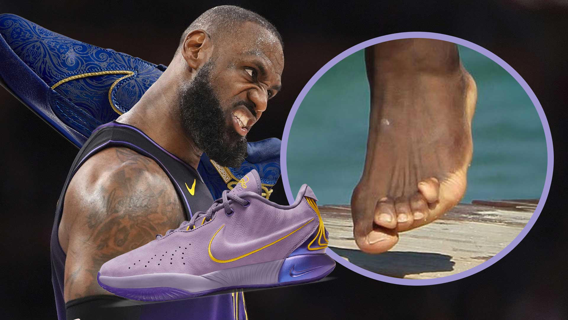 Did Nike Sneakers Ruin LeBron Jamesâ Feet? New Photos Spark Debate