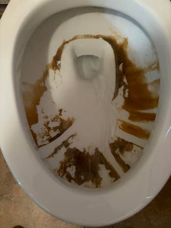 Dirty toilet bowl with extensive brown staining and buildup inside