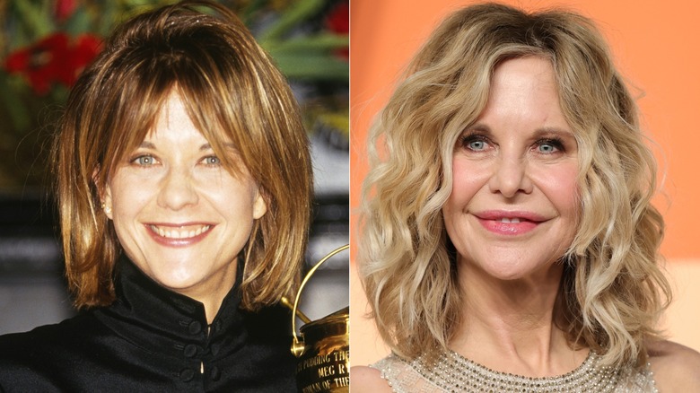 How Meg Ryan's Face Has Transformed Over The Years, According To Our  Plastic Surgeon