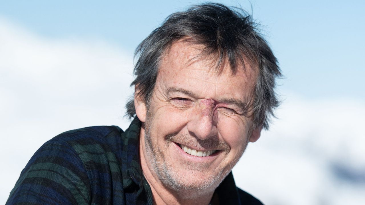 Jean-Luc Reichmann humilié : cette intervention pour retirer son angiome qui  l'a traumatisé, "Je n'avais pas 10 ans"